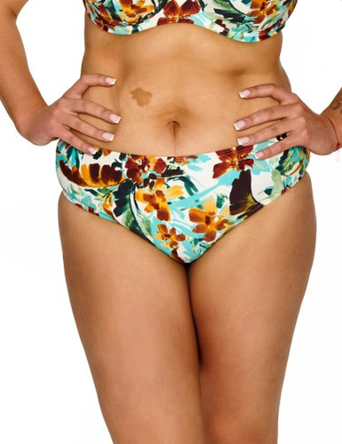 Gaia 1 Lupoline bikini alsó – magasított derék és kényelmes fazon